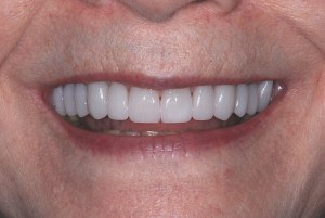 cosmetic dentist in Asheville, NC