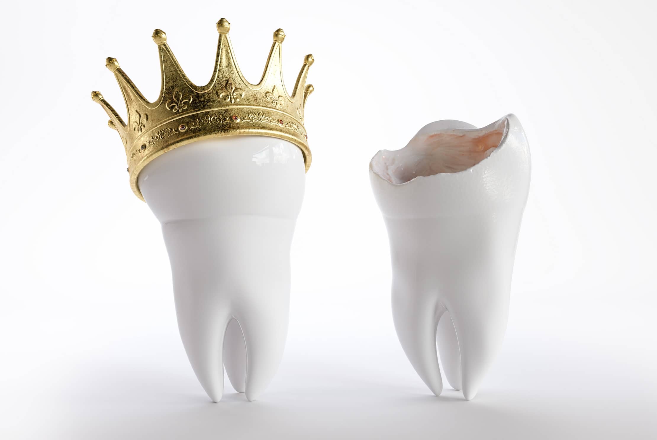 dental crown in Asheville, NC